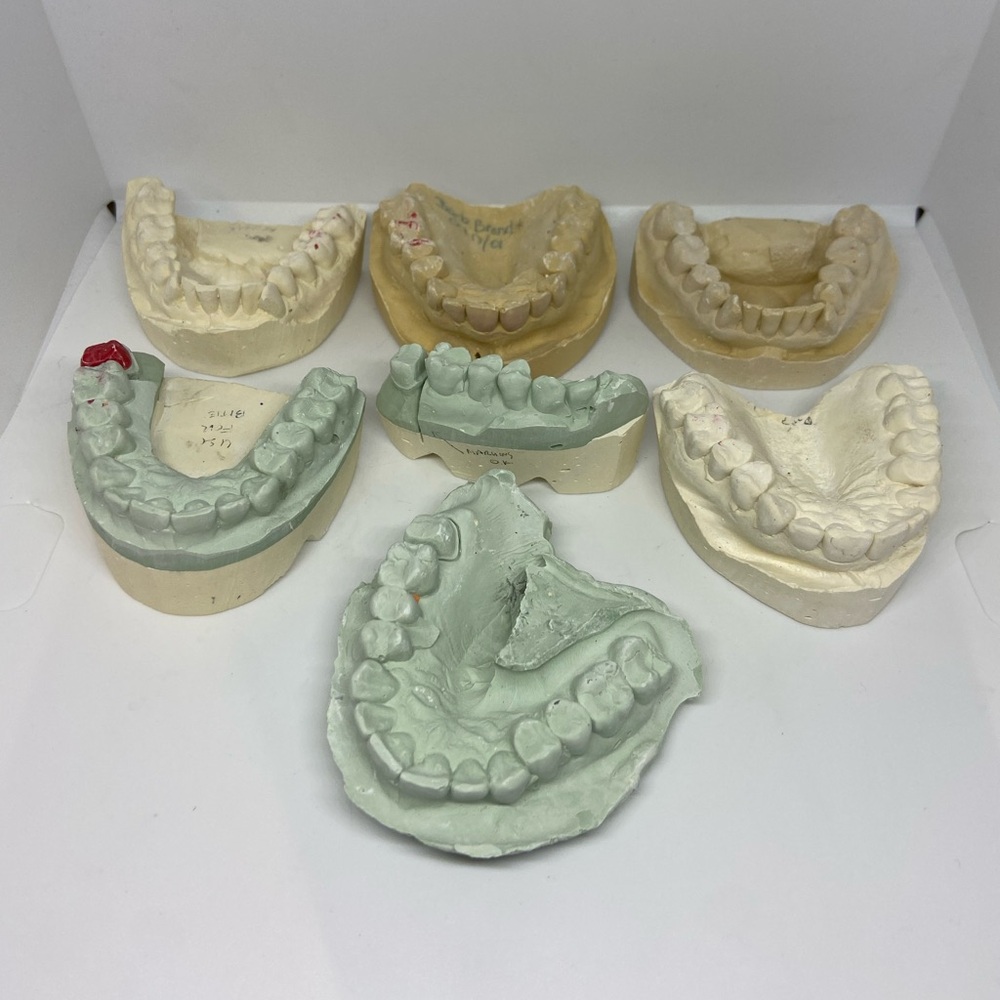 Vintage Plaster Dental Molds Teeth Creepy Oddity Curiosities Oddities Halloween